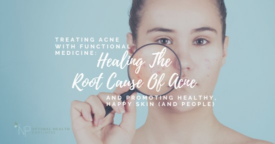 Treating Acne With Functional Medicine: Healing The Root Cause Of Acne And Promoting Healthy, Happy Skin (And People)